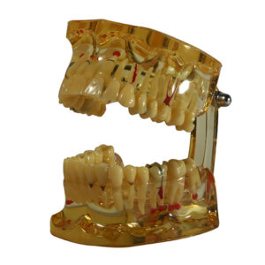 TIPODONTO TRASPARENTE CON IMPLANTES, PREPARACIONES Y RAICES